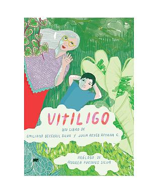 Vitiligo
