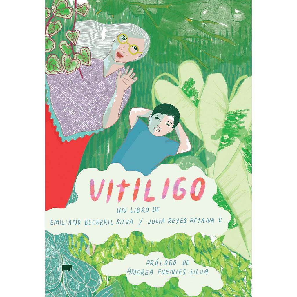 Vitiligo